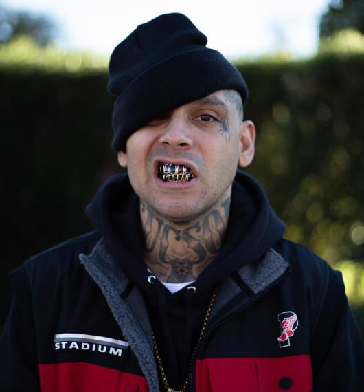 Gold Teeth